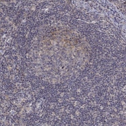 ALKBH8 Antibody, Novus Biologicals 25 &mu;L, Unlabeled:Antibodies, Polyclonal
